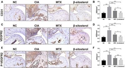 β-Sitosterol Inhibits Rheumatoid Synovial Angiogenesis Through Suppressing VEGF Signaling Pathway